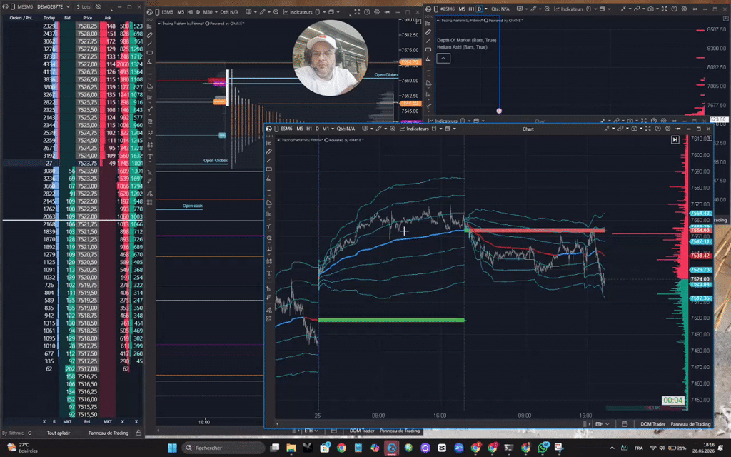 Travaillez votre trading dans le bon sens
