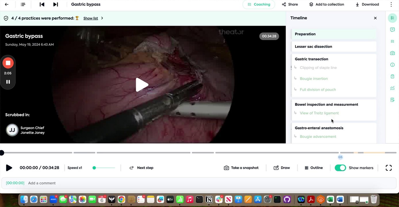 Preview of Theator's case page: Timeline and video controllers 