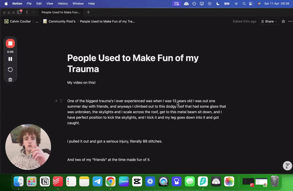 People Used to Make Fun of my Trauma